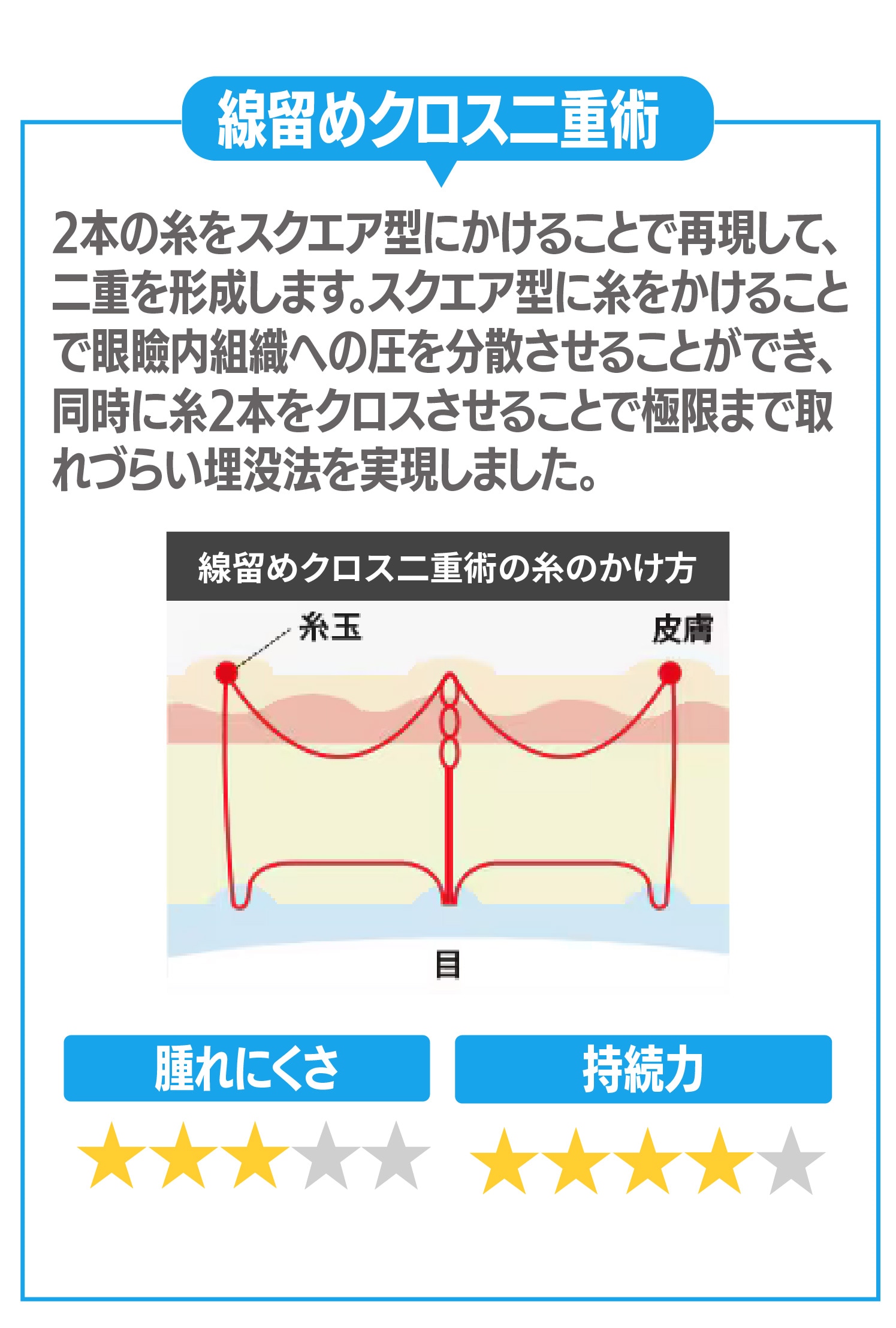 ②線留めクロス二重術について