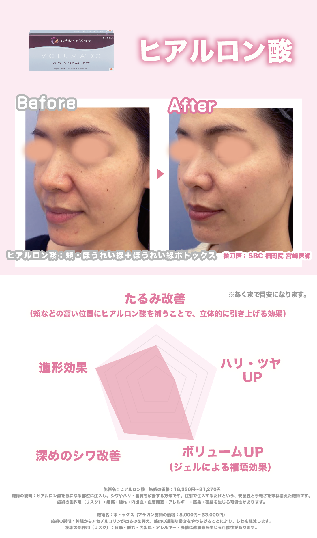 即効性と自然な仕上がりで叶える立体的な若返り