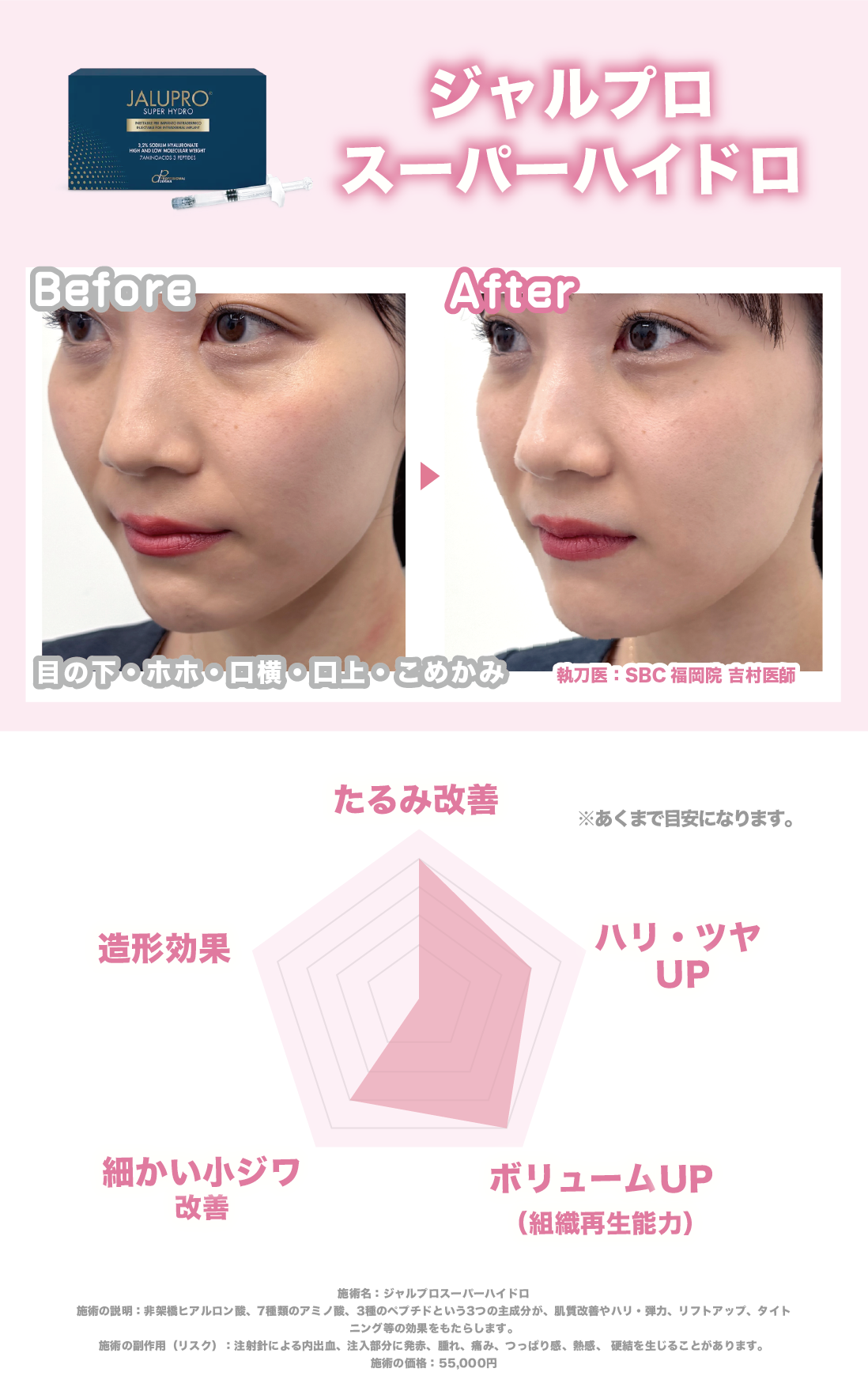 肌の「土台」から再構築する、次世代のリフトアップ治療