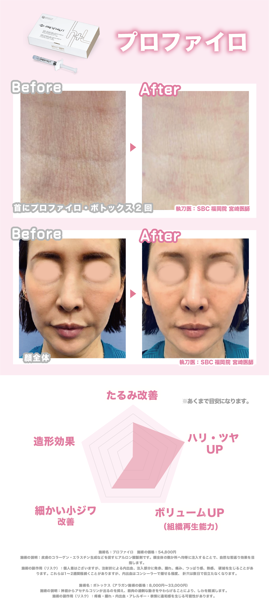 肌の土台を丸ごと作り変える「バイオリモデリング治療」