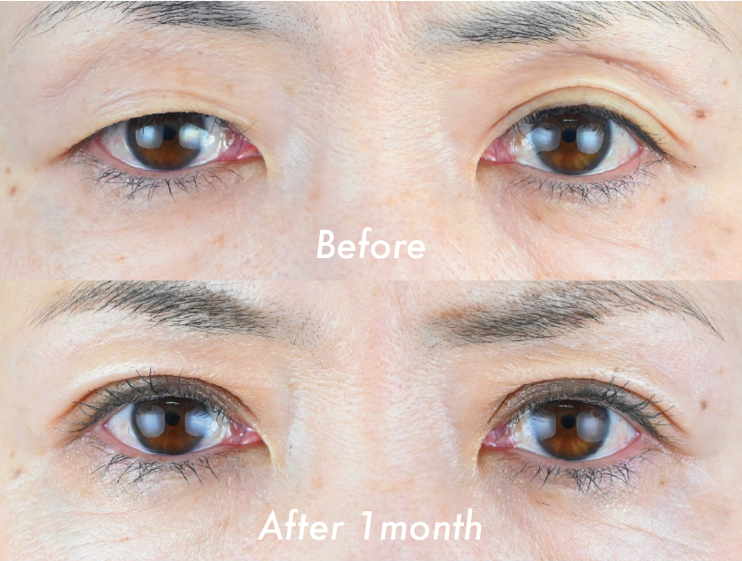 【40代女性】クイックコスメティーク・トリプルNeo