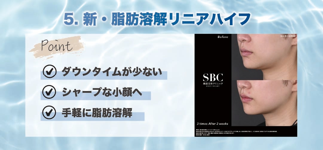小顔・即効性を求めるなら【新・脂肪溶解リニアハイフ】<br />
