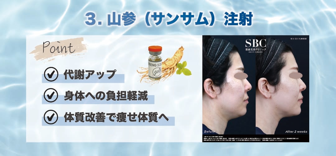 体質改善を同時に目指す【山参（サンサム）注射】