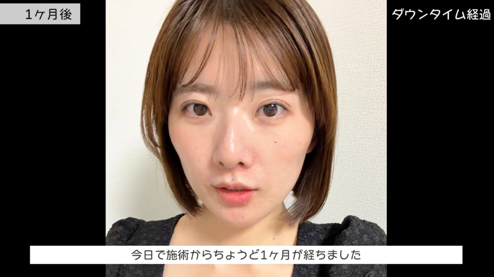 【完成（約1ヶ月後）】<br />
※個人差がございます