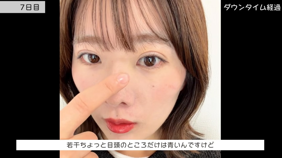 手術から1週間後