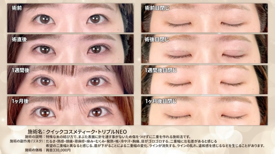ビフォー・アフター