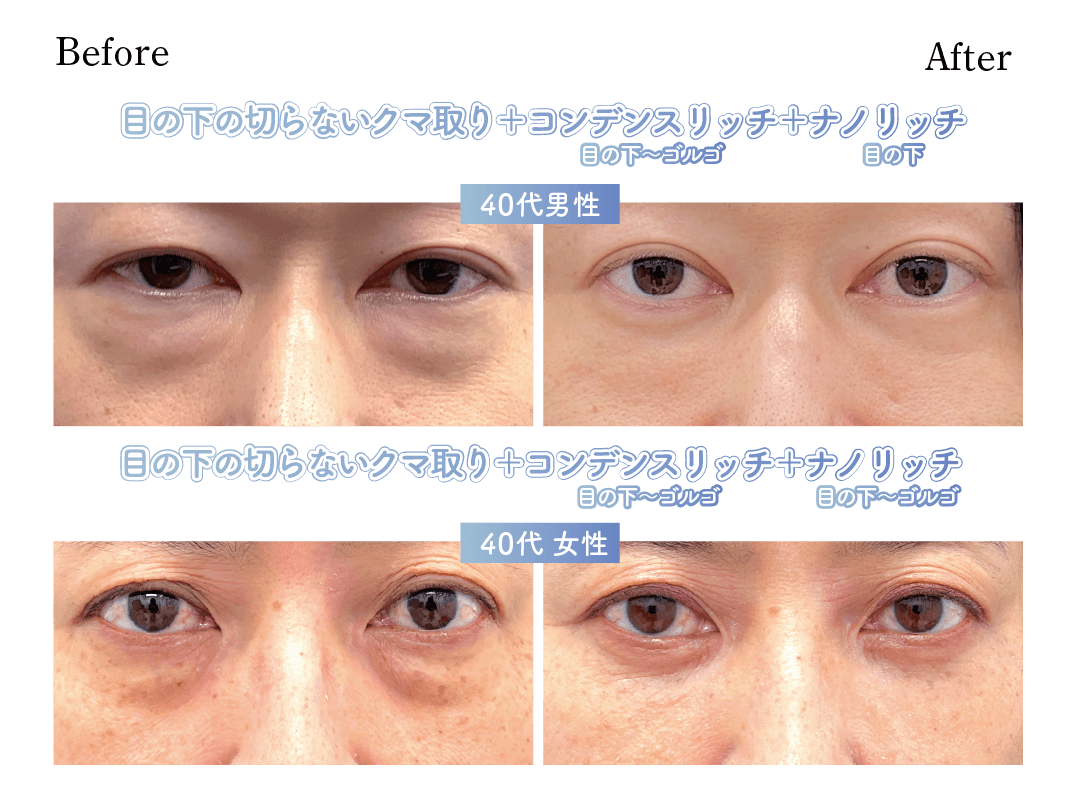40代症例