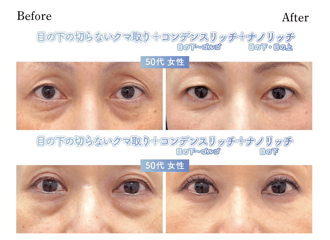 50代症例