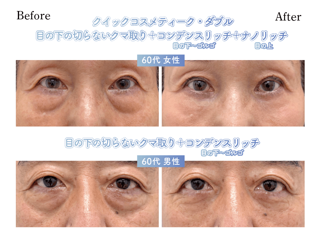 60代症例