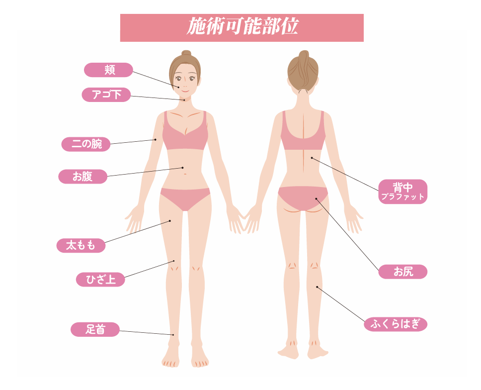 対応部位