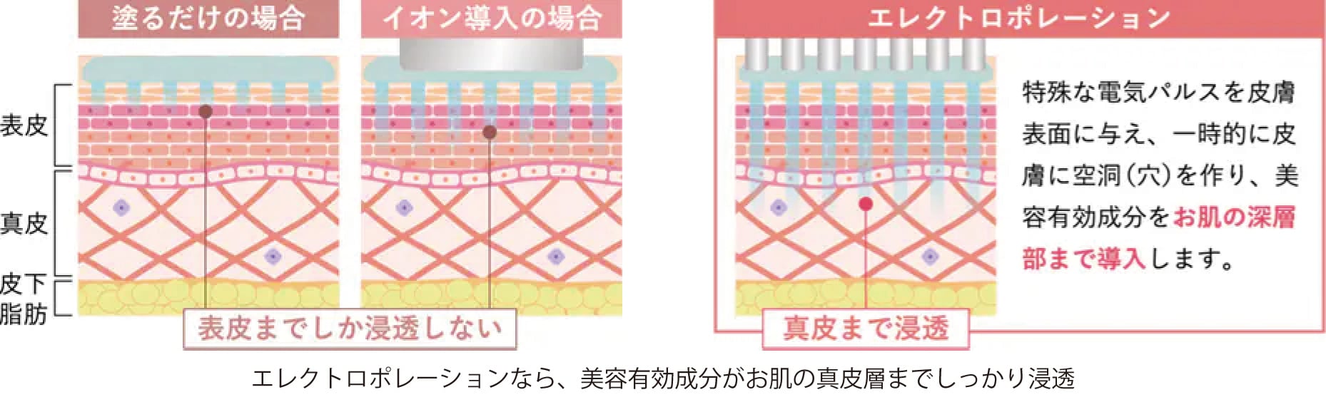 エステや家庭用のイオン導入との違い
