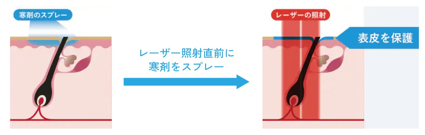 痛みを軽減させる冷却機能搭載