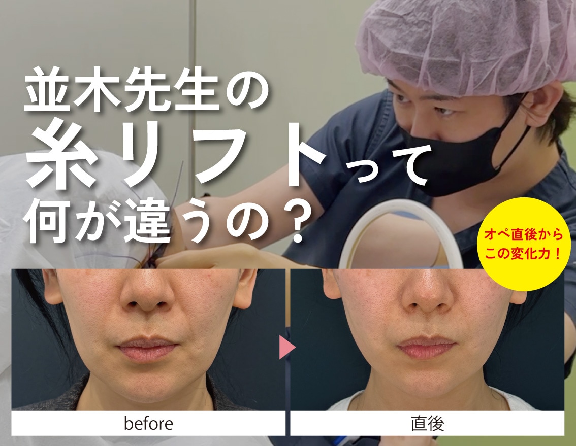 【圧倒的美的センス】並木先生の糸リフトってなにが違うの？【たるみ・もたつき】【福島で若返りならSBC】