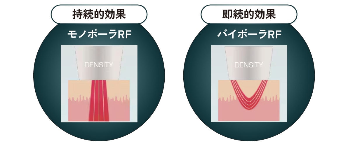 モノポーラ+バイポーラのモノバイ技術