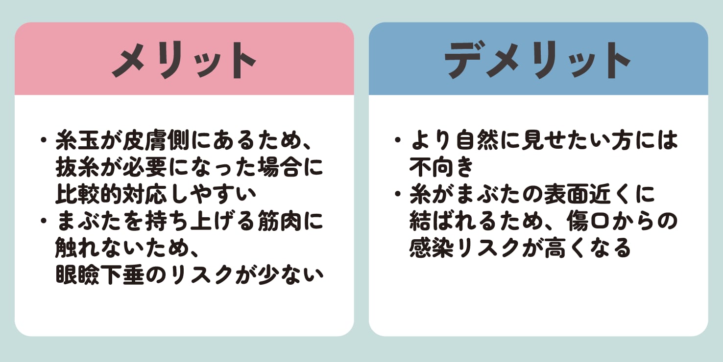 表留めのメリット・デメリット