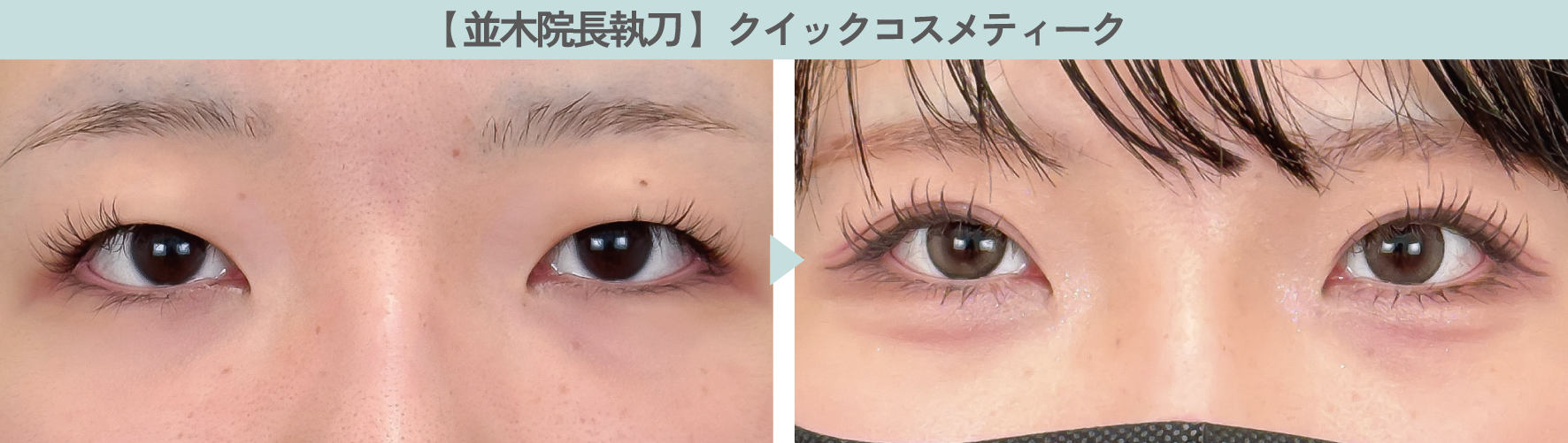 【人気No.1】クイックコスメティーク