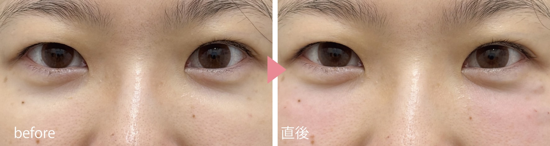 福島院スタッフも受けてみました