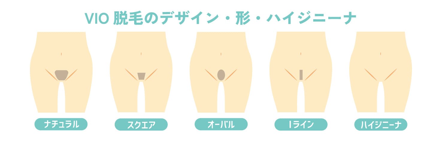 デザイン・毛量調整が可能