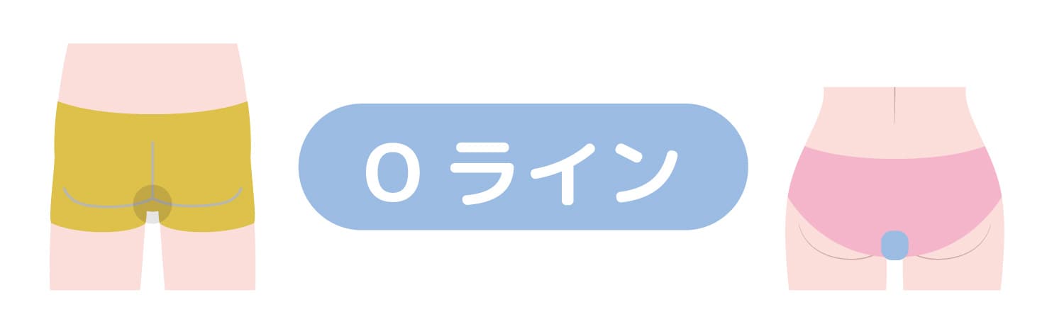 Oライン