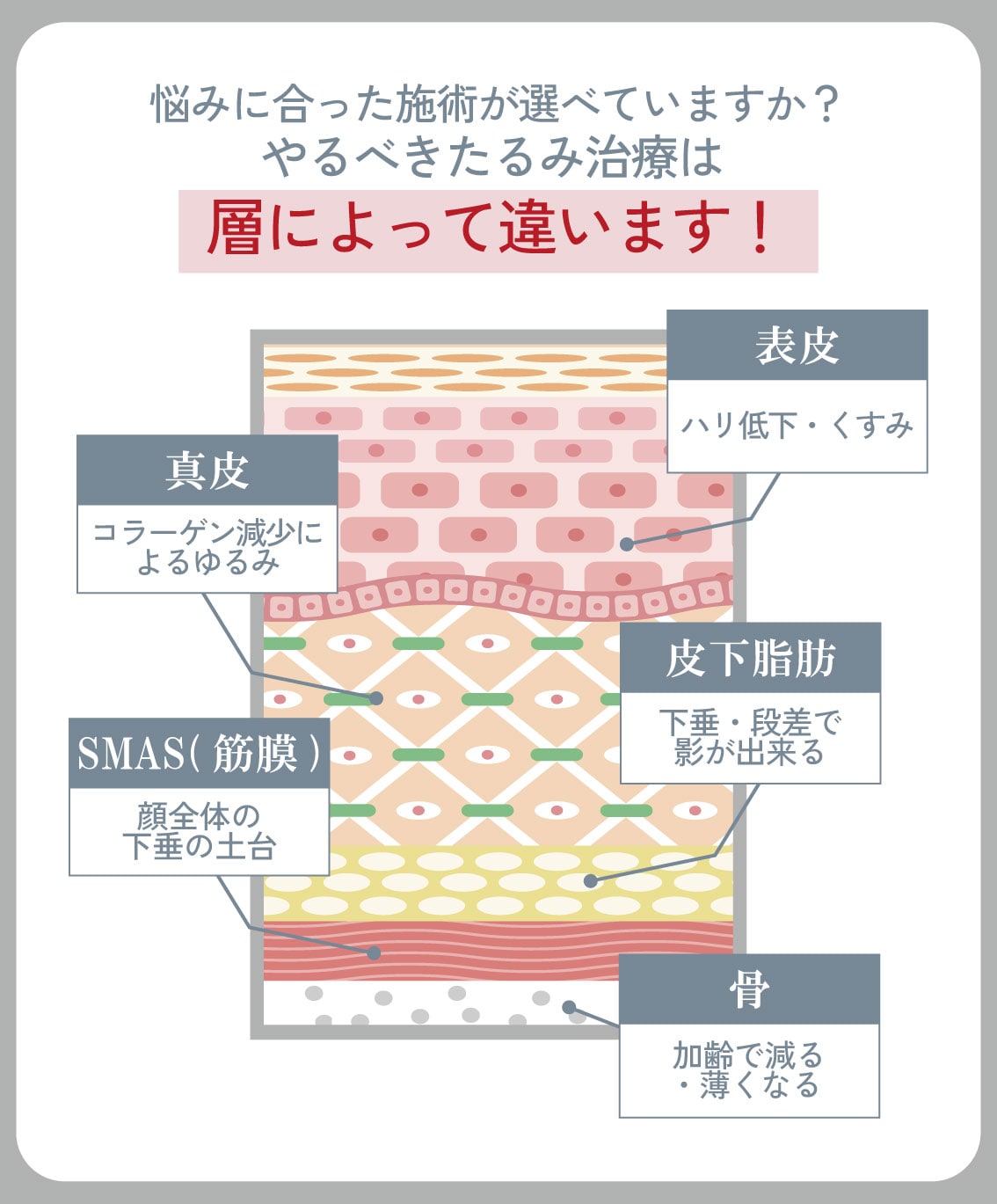 たるみは複数の層が関係して起こる症状