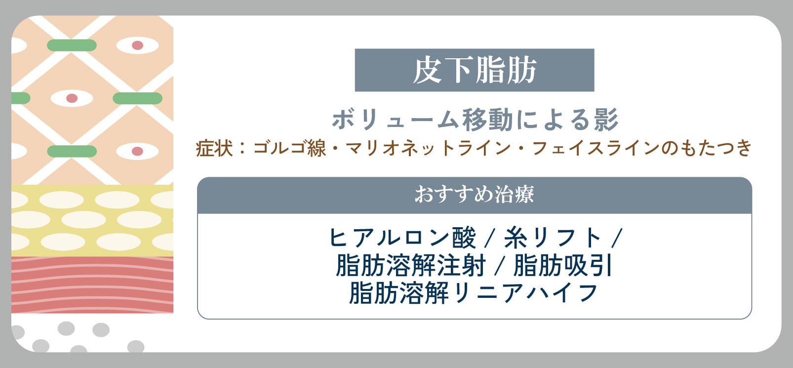 フェイスラインのもたつき・ほうれい線が深くなるたるみ
