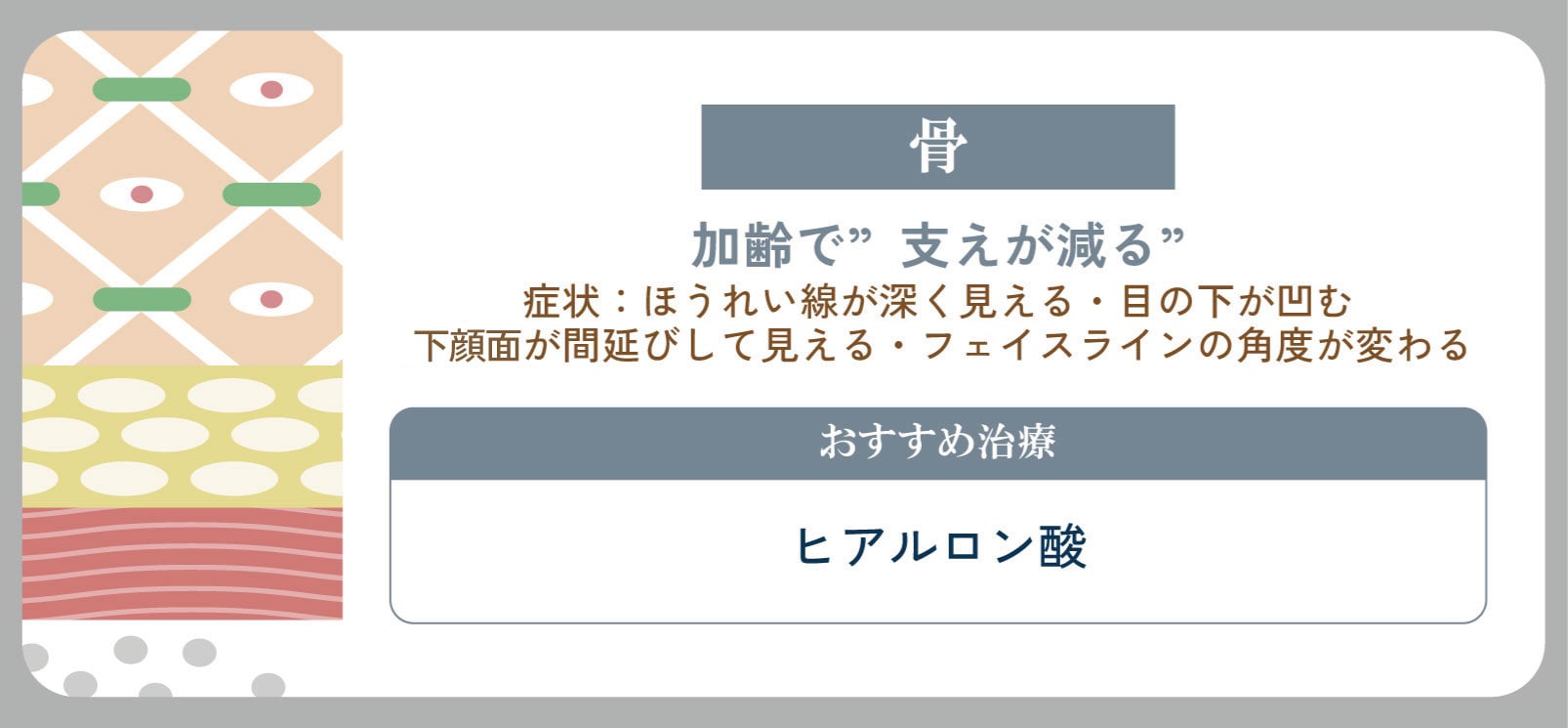 支えが減ることで起こる“凹みと影のたるみ”