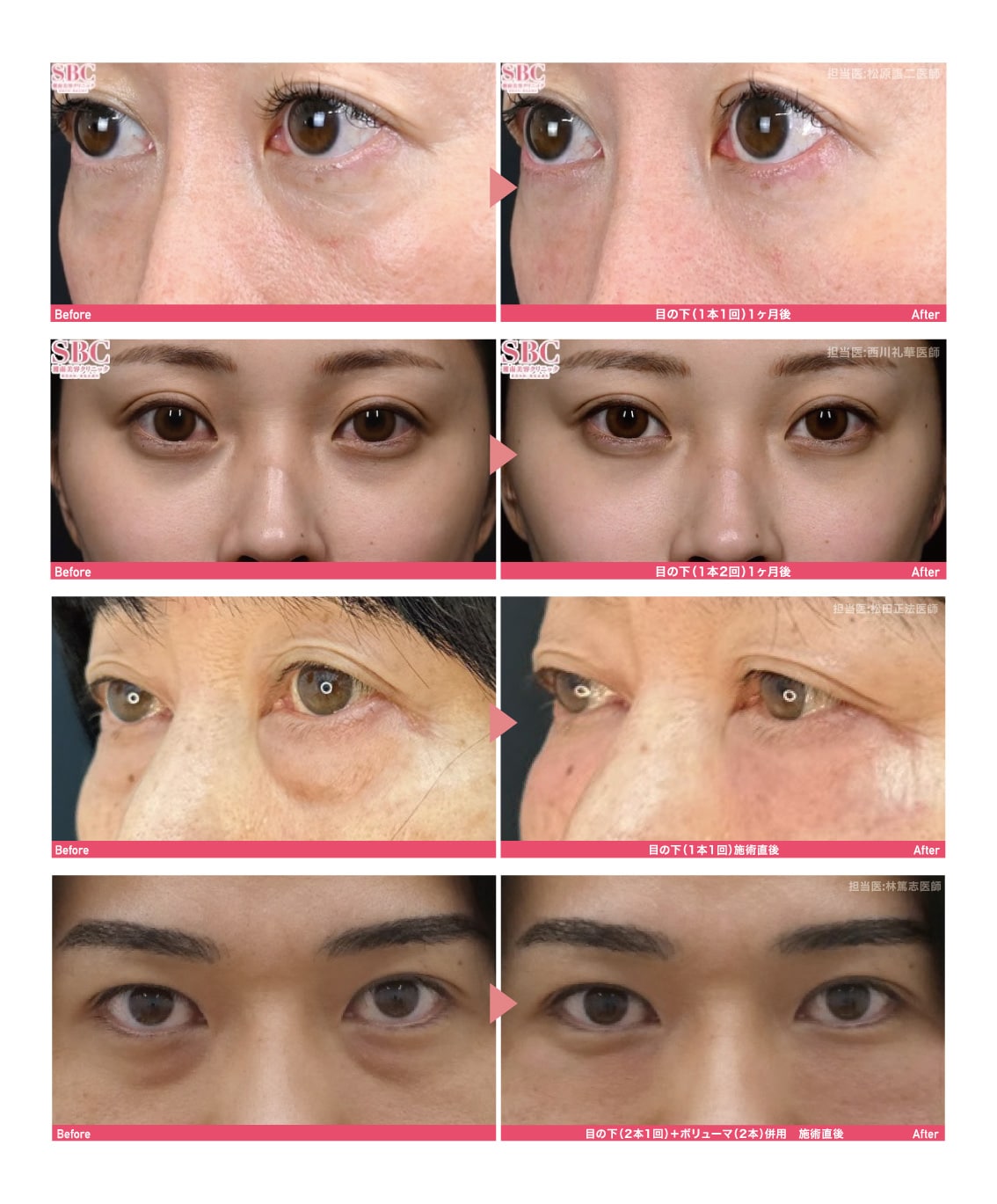 明るい目元へ◎