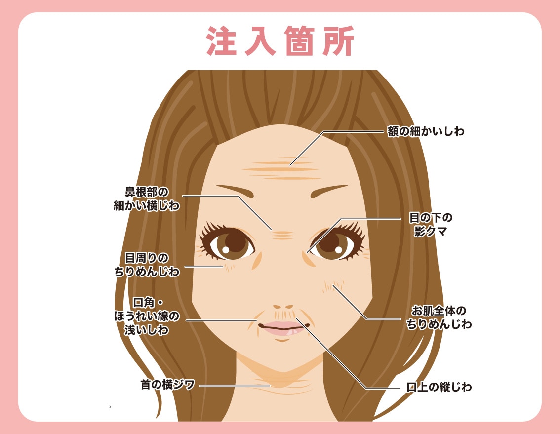 小じわやクマのお悩みに◎