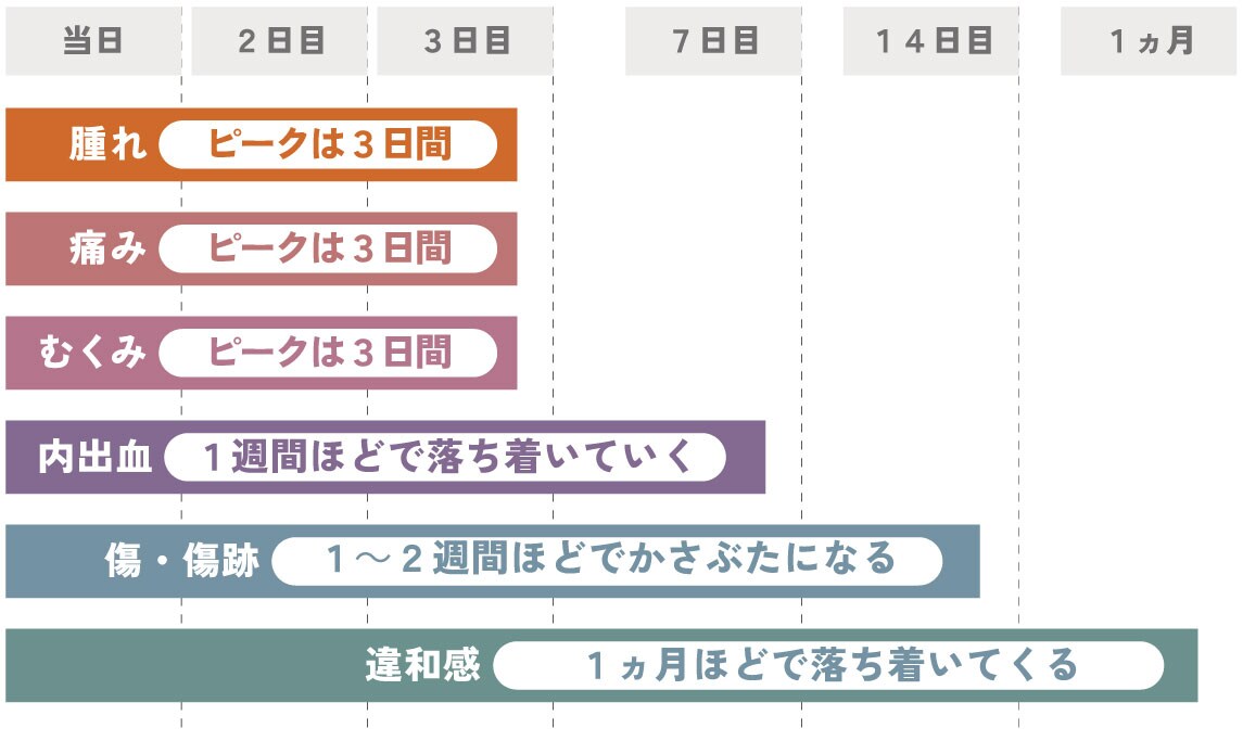ダウンタイム