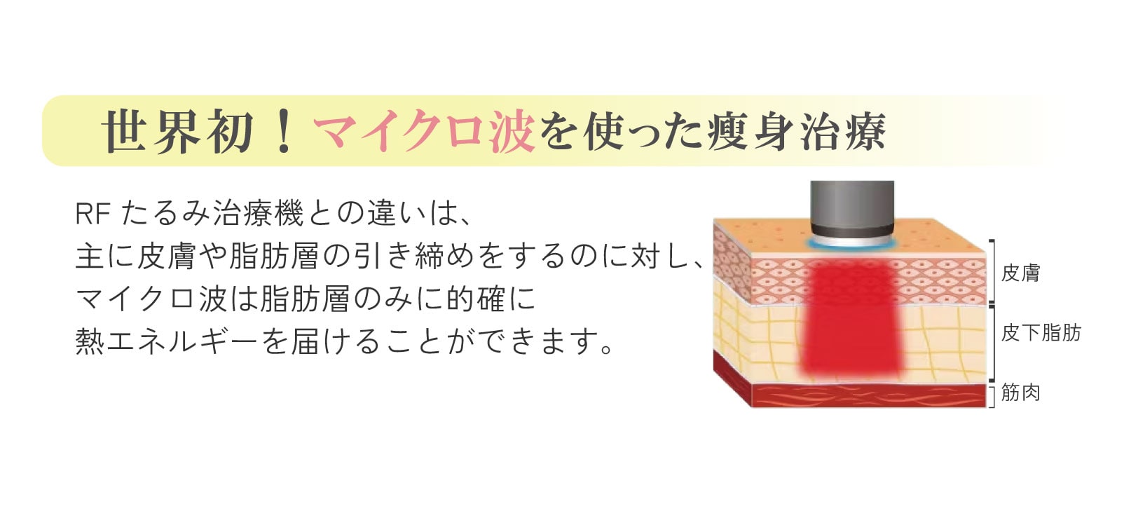 最新小顔痩身治療【オンダリフト】とは？