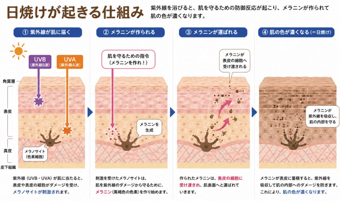 日焼けは、肌が自らを守るための防御反応