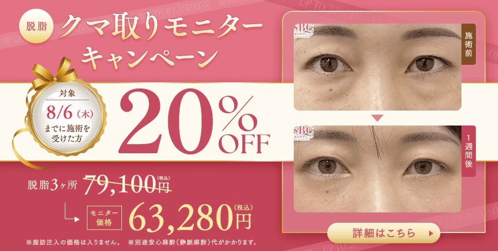 クマ取り(脱脂)＜モニター20%OFF＞キャンペーン