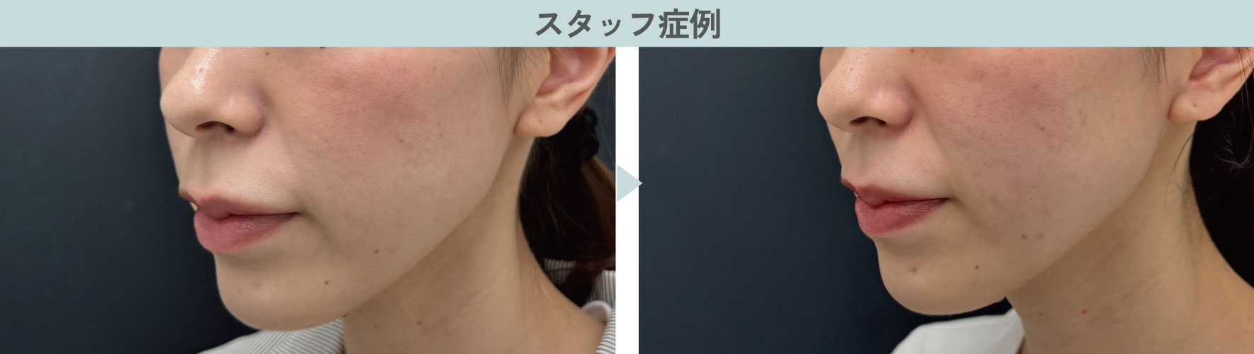 スタッフが受けてみた感想