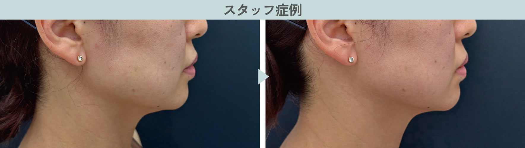 スタッフが受けてみた感想