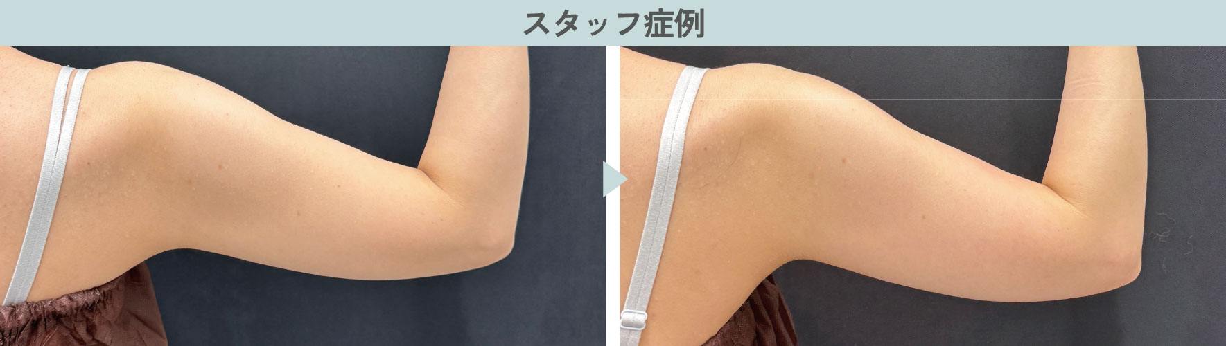 スタッフが受けてみた感想