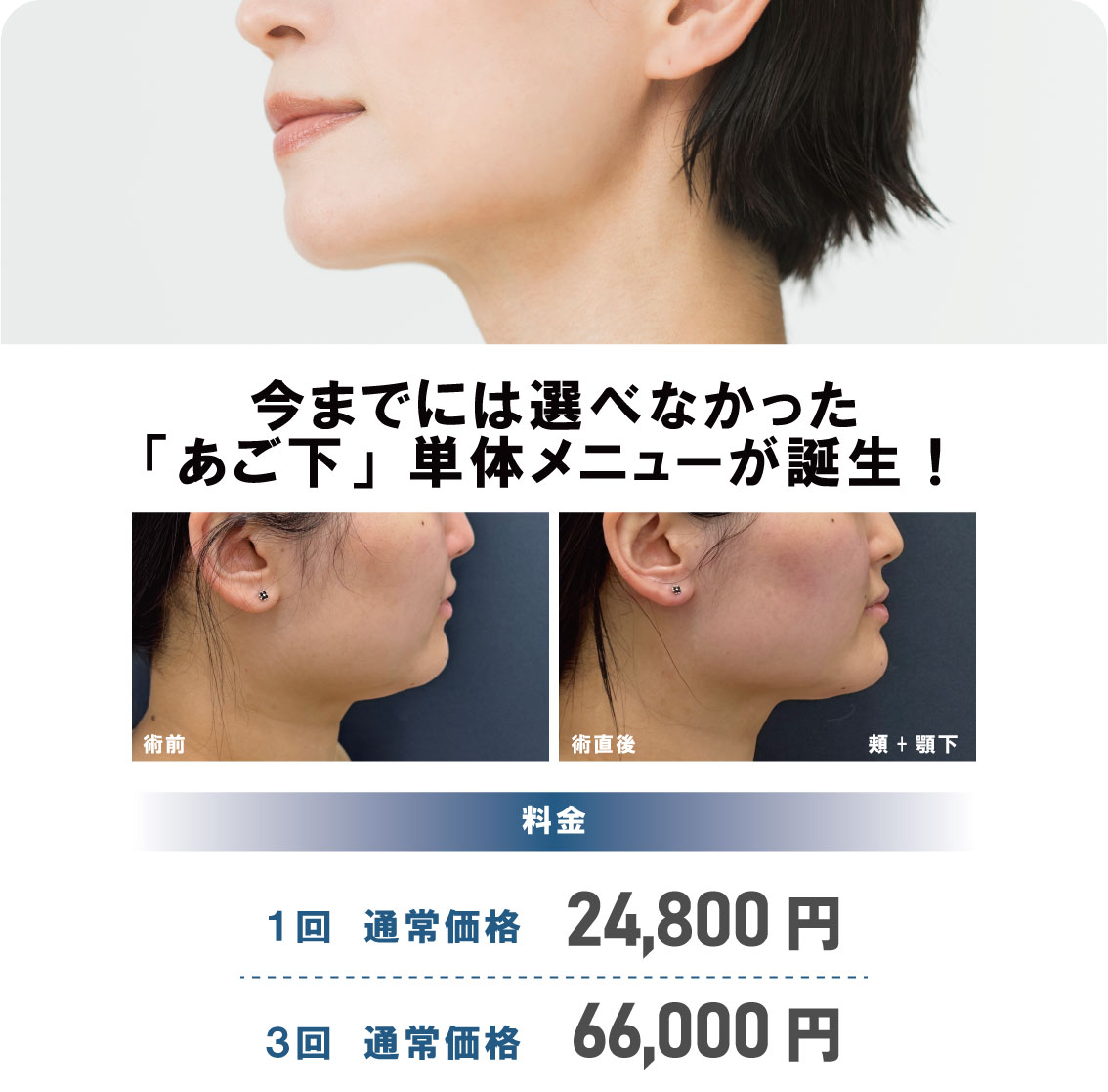 「顎下」単体メニューが登場！