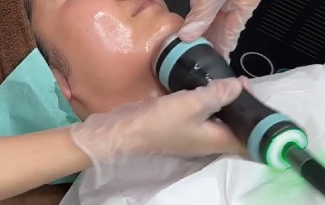 顔・ボディの脂肪溶解が可能な最新治療機器