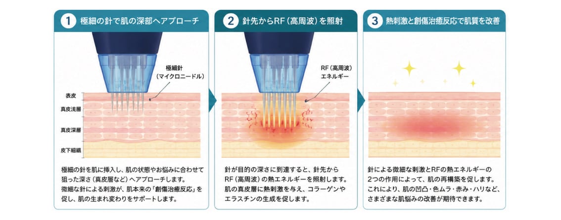 シルファームXの仕組み