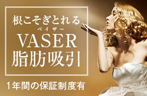 ベイザー脂肪吸引