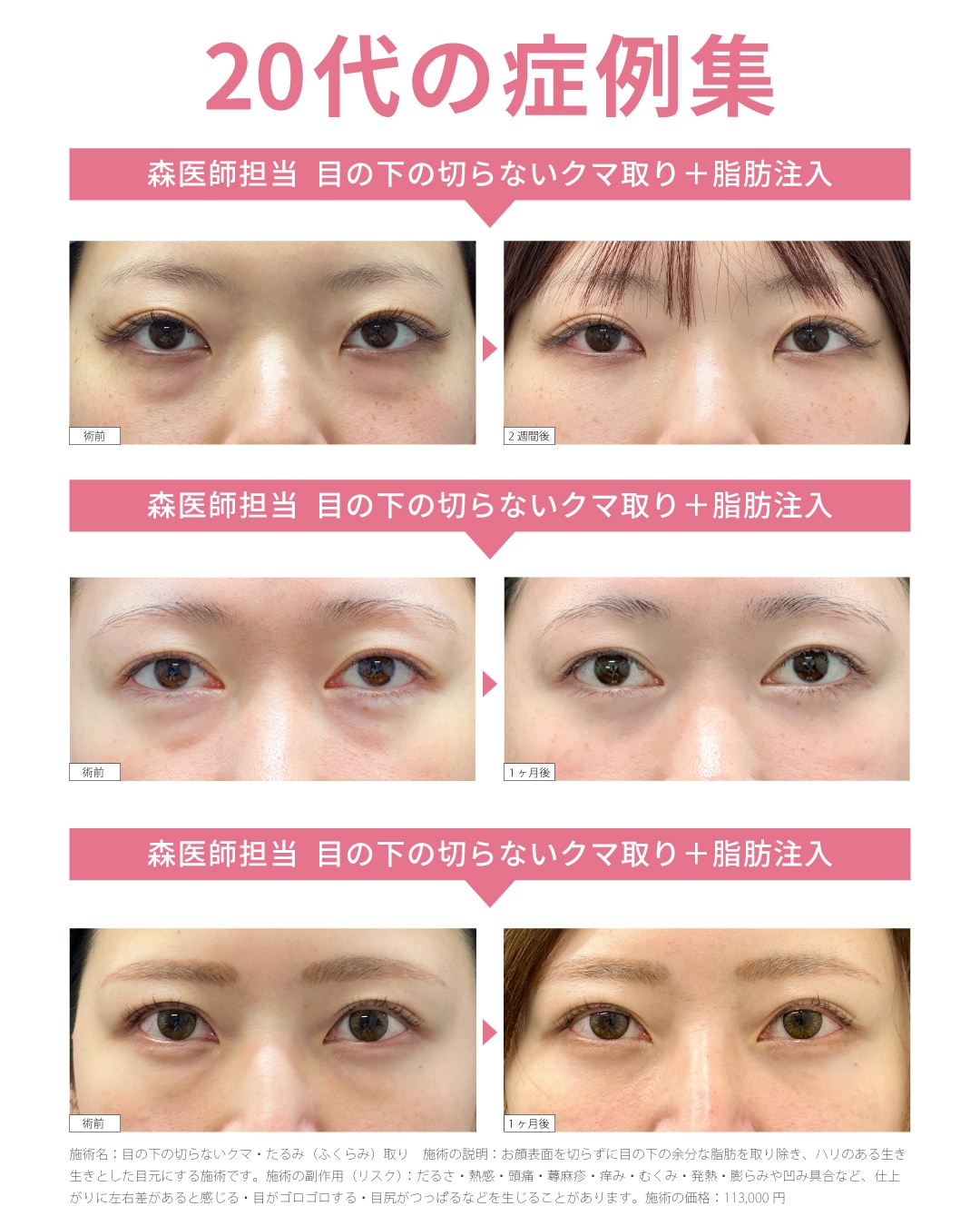 福山【クマ取り名医】形成外科専門医！『クマ・たるみ取り』なら湘南美容クリニック福山院の森医師へおまかせ♪ - 福山院, image size:1080x1350