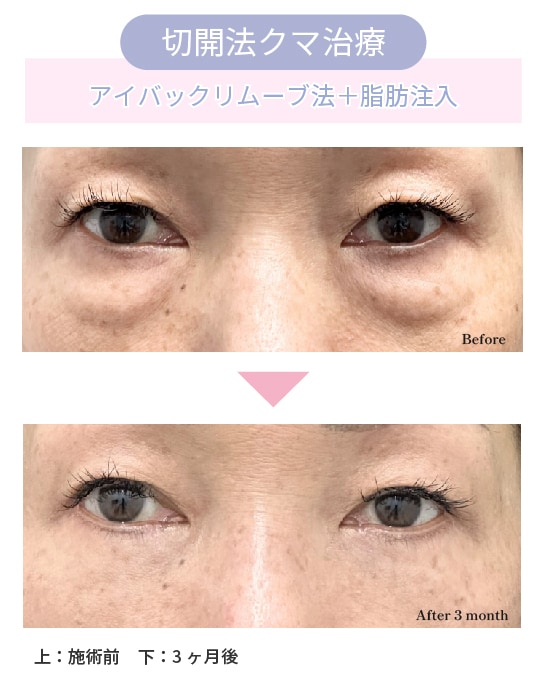 50代女性の症例解説