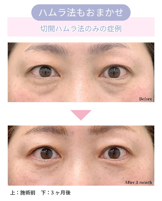 40代女性の症例解説