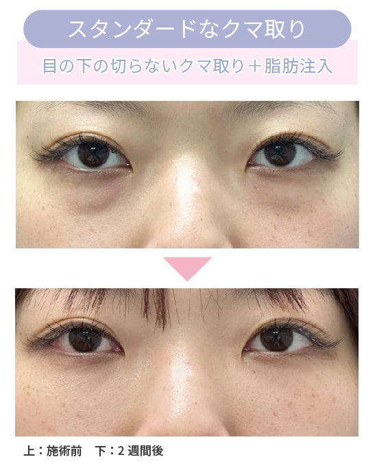 20代女性の症例解説