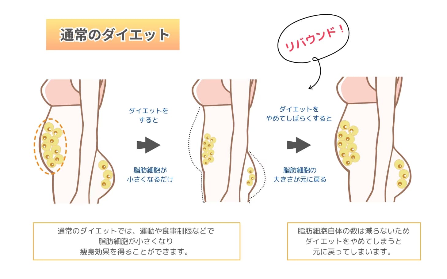 通常のダイエットとは根本から違うので、部分痩せした後もリバウンドしません!
