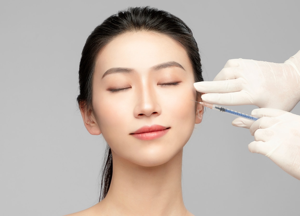 中顔面（目の下から口元まで）ボトックスとは、筋肉ではなく皮膚の浅い層（真皮層）に注入する「マイクロボトックス」