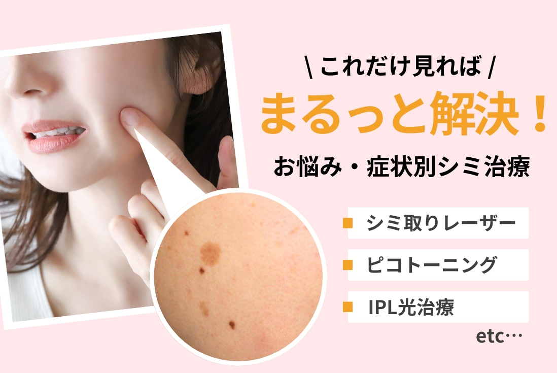 これだけ見ればまるっと解決！SBC福山院でお悩みごとにピッタリのシミ 