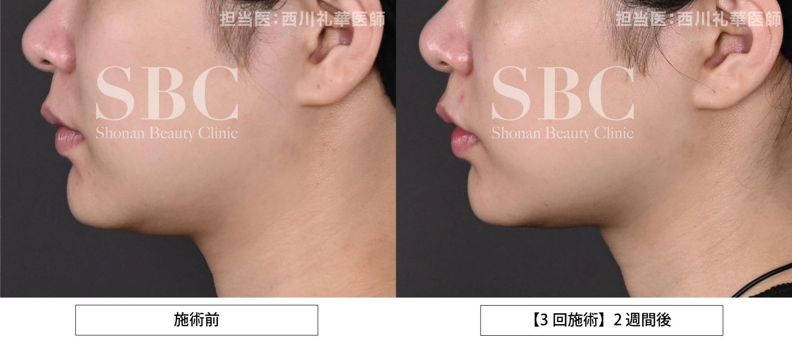 症例写真の紹介