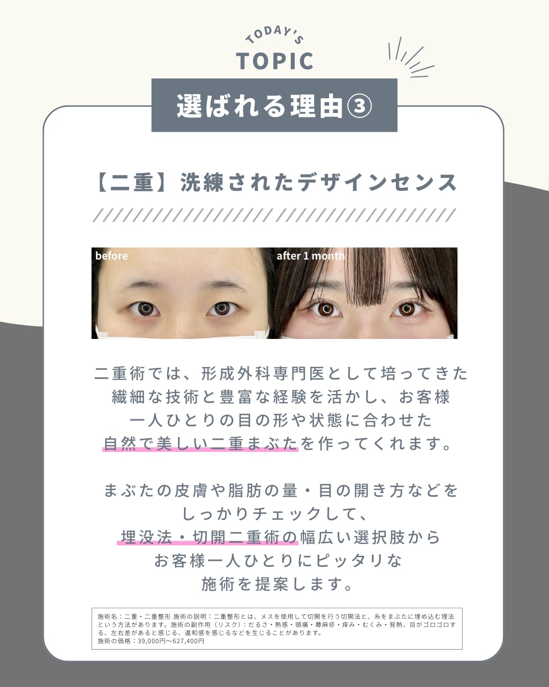 選ばれる理由③3期連続✨フォーエバー二重術 執刀数 No.1