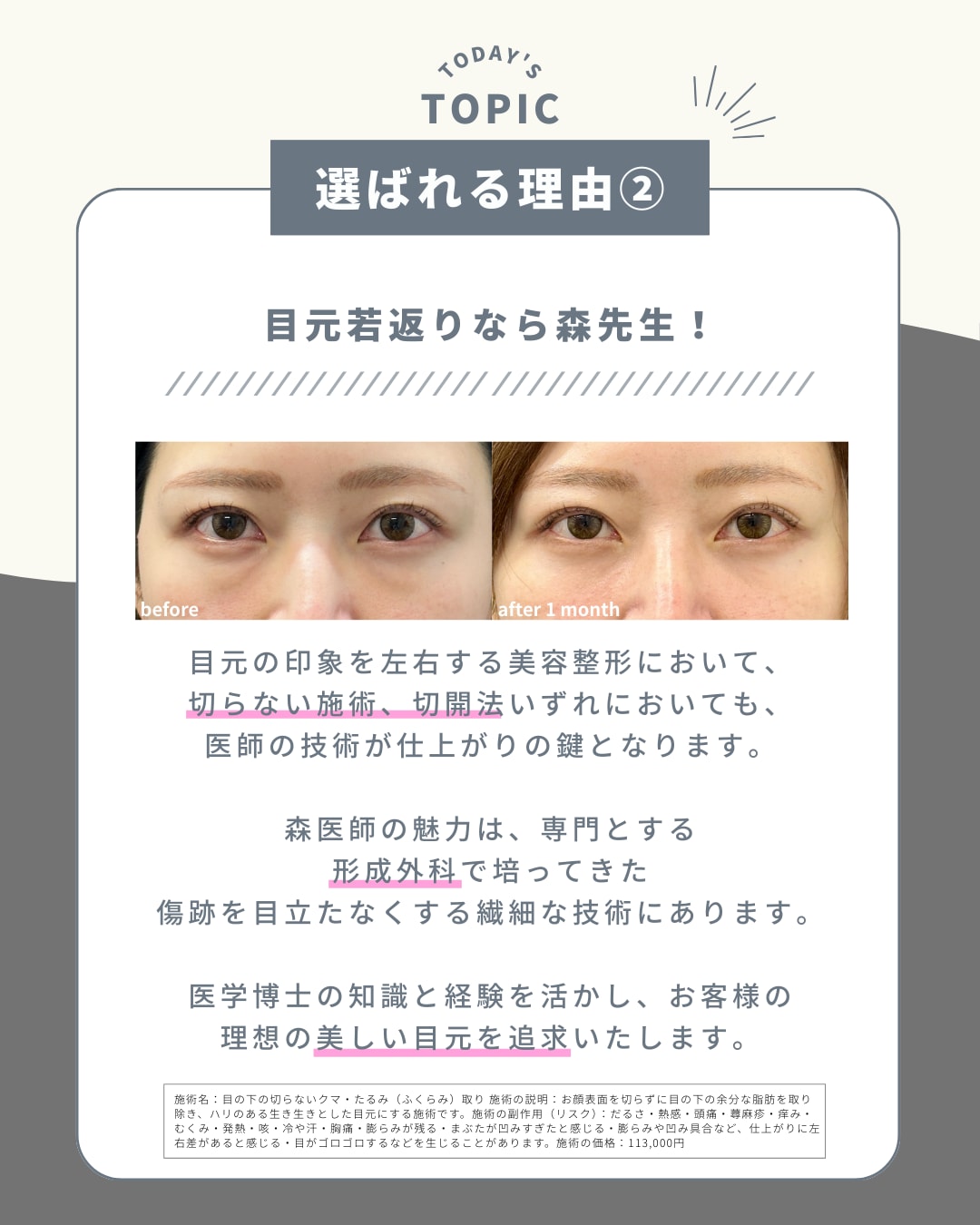 選ばれる理由②目元若返りなら森先生！