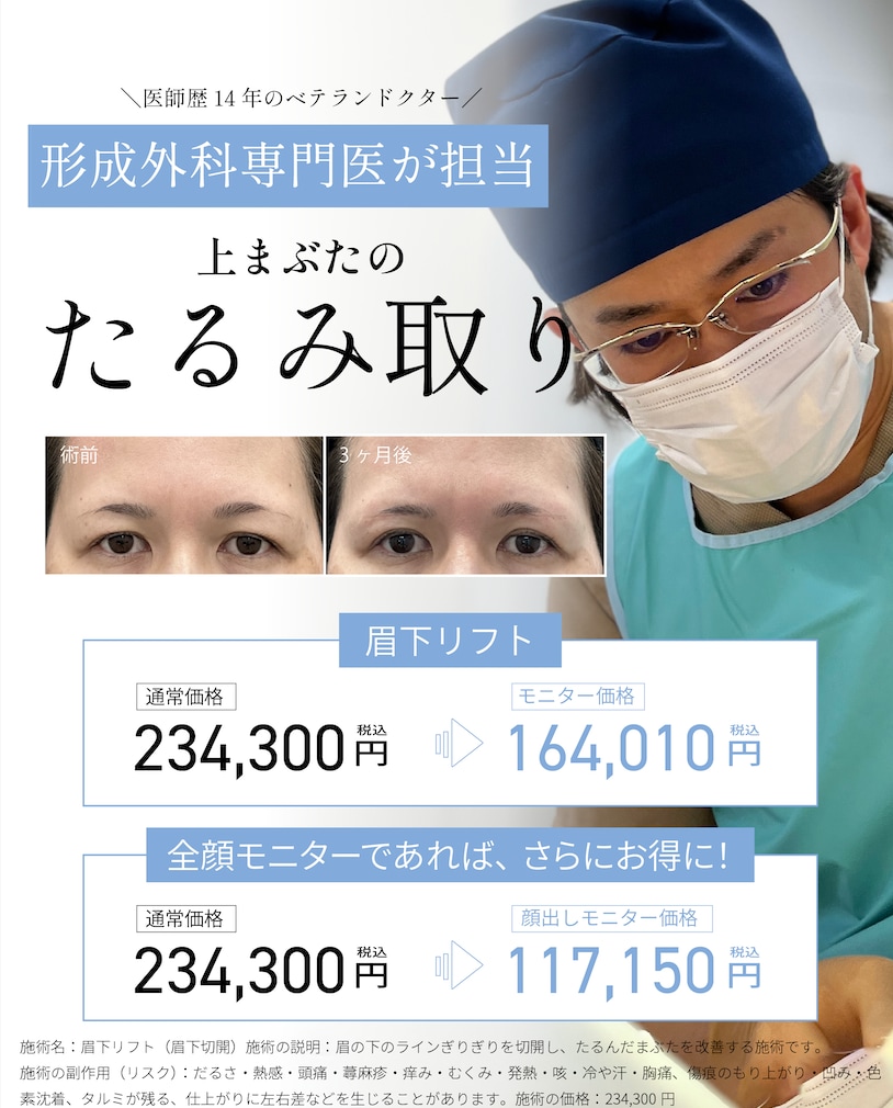 上まぶたのたるみ取り(眉下切開)モニター募集中
